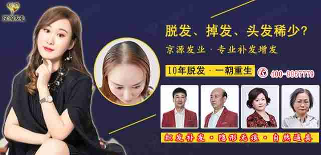 假发品牌有哪些（全国假发品牌排行）-第1张图片