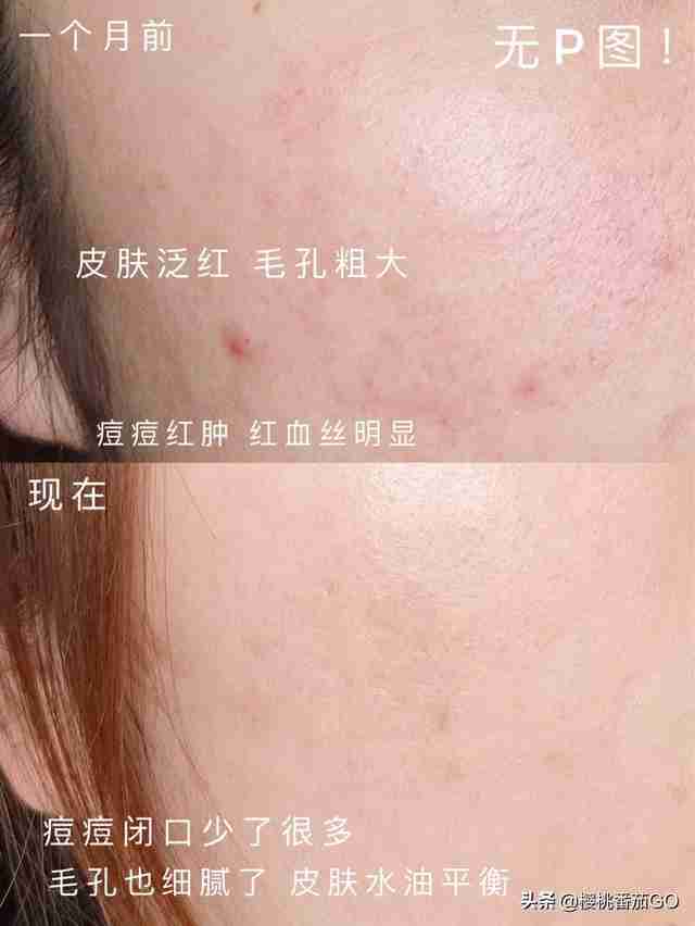 补水保湿产品排行（保湿补水效果好的护肤品排行榜）-第1张图片